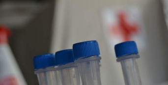 CVP disponibilizou cerca de 100 mil testes &agrave; Regi&atilde;o Aut&oacute;noma da Madeira